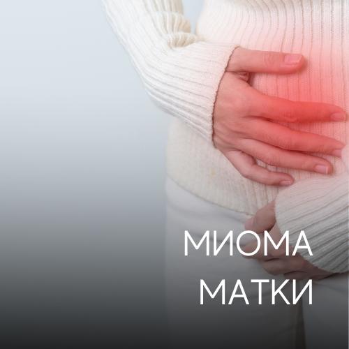 Миома матки: современные методы диагностики и лечения