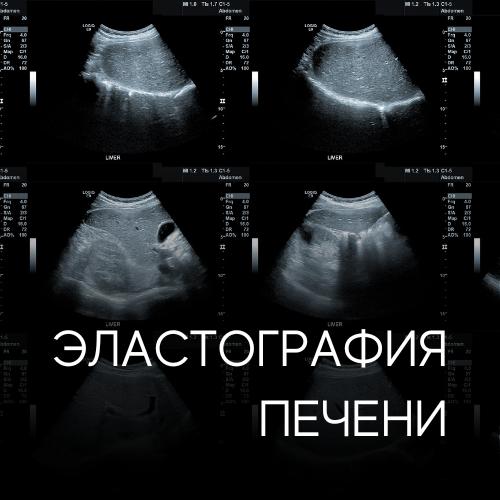 Эластография печени — когда важно узнать правду о своём здоровье